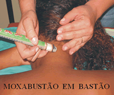 http://www.ibted.org.br/Figuras/Texto/moxa2.gif