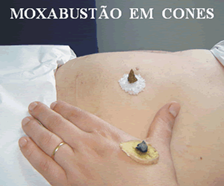 http://www.ibted.org.br/Figuras/Texto/moxa1.gif